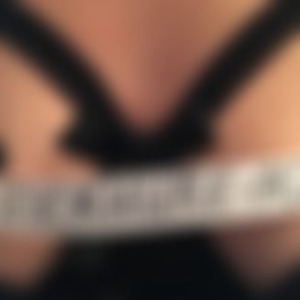 FICKHURE-AO